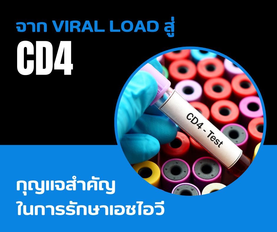 จาก Viral Load สู่ CD4 กุญแจสำคัญในการรักษาเอชไอวี