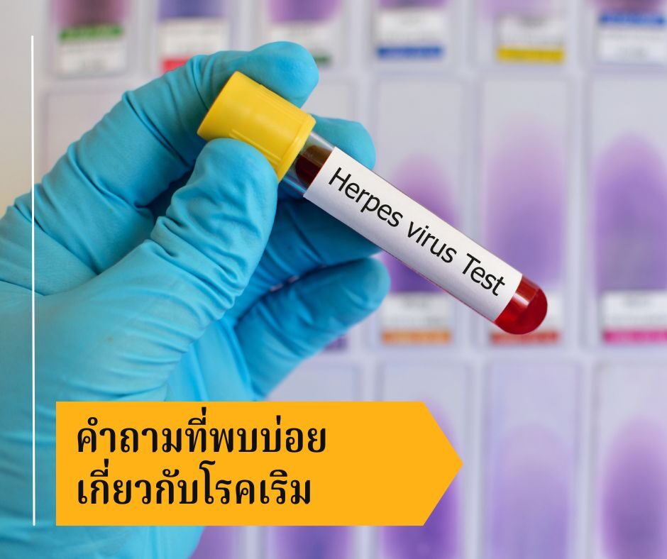 คำถามที่พบบ่อยเกี่ยวกับโรคเริม