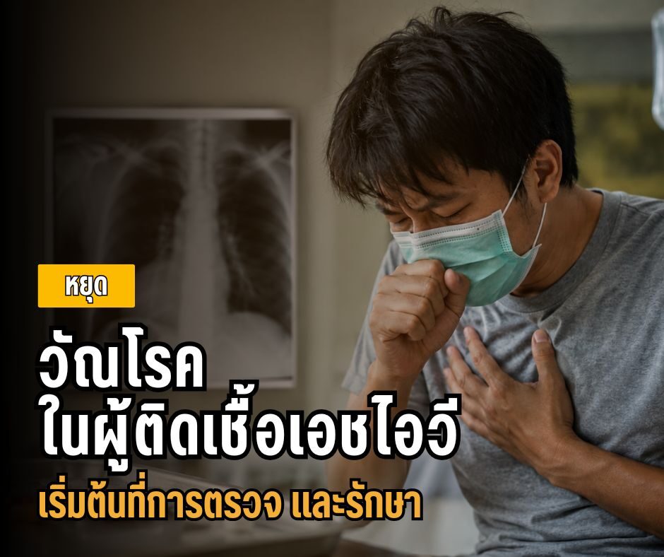 หยุดวัณโรคในผู้ติดเชื้อเอชไอวี เริ่มต้นที่การตรวจ และรักษา