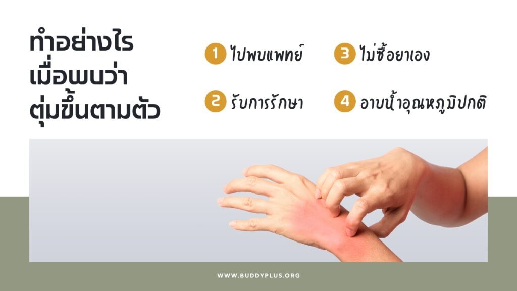 ตุ่มขึ้นตามตัว หมายถึงติด HIV แล้วใช่ไหม