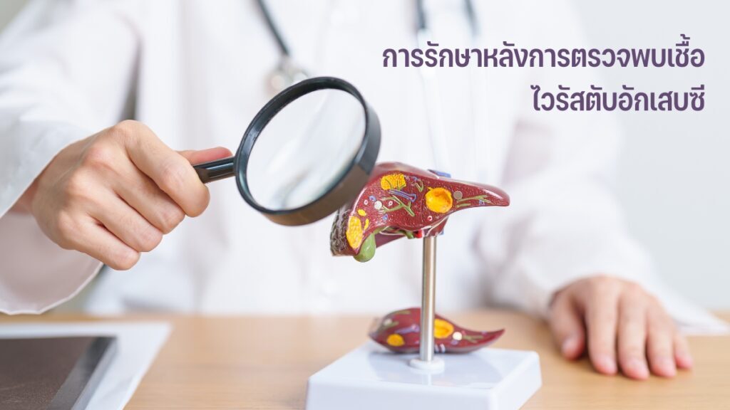 การรักษาหลัง การตรวจไวรัสตับอักเสบซี