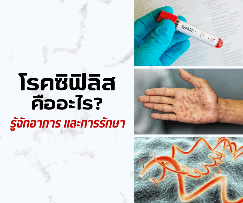 โรคซิฟิลิส คืออะไร? รู้จักอาการและการรักษา