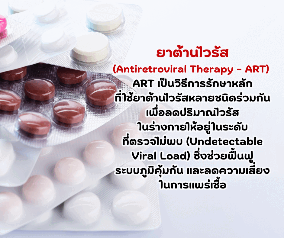 การรักษาเอชไอวี
