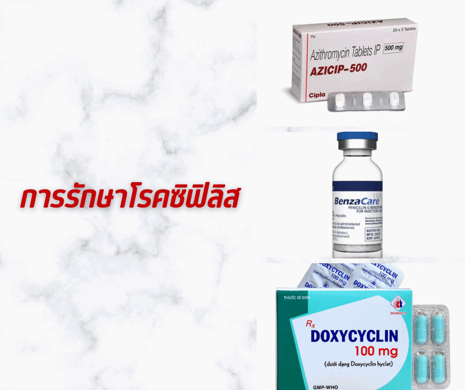 การรักษาโรคซิฟิลิส