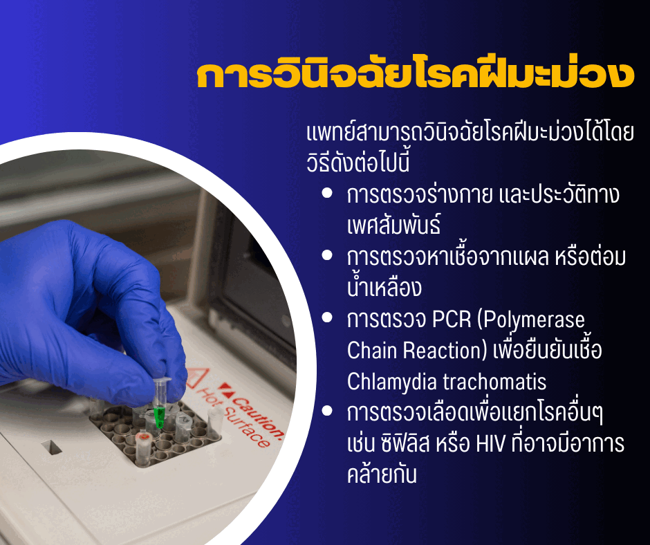 การวินิจฉัยโรคฝีมะม่วง