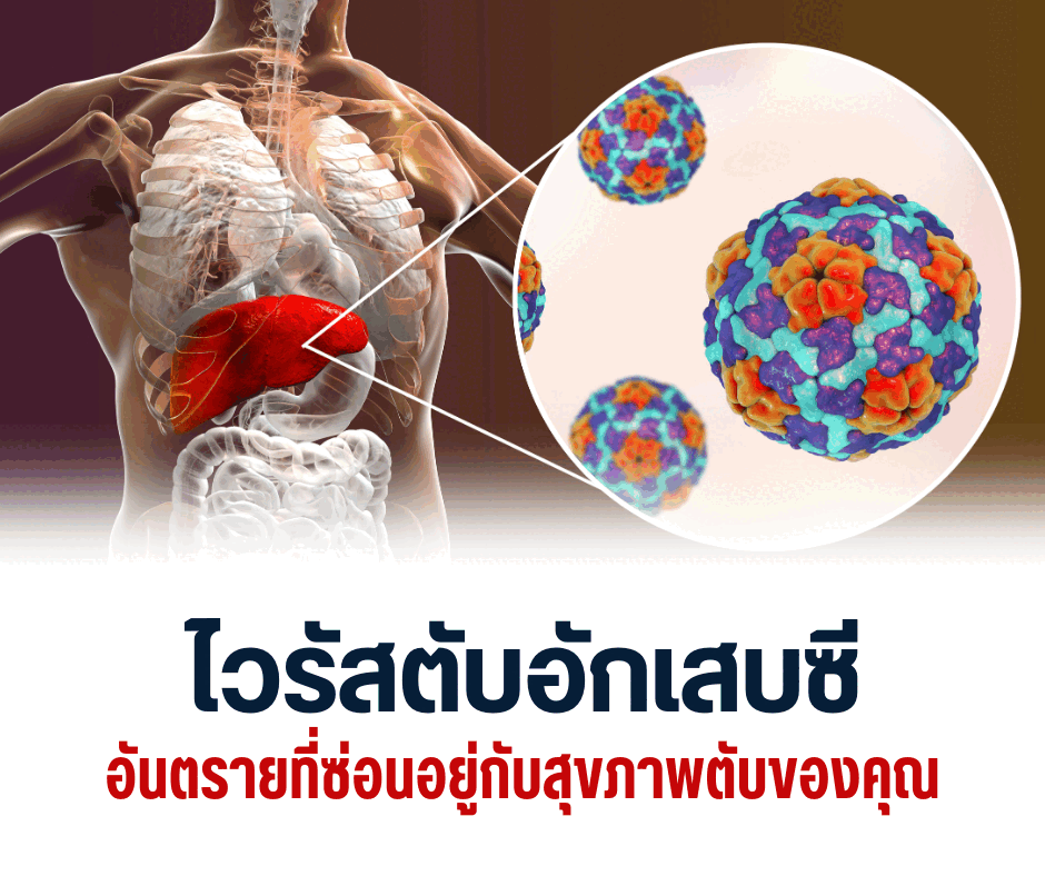 ไวรัสตับอักเสบซี อันตรายที่ซ่อนอยู่กับสุขภาพตับของคุณ