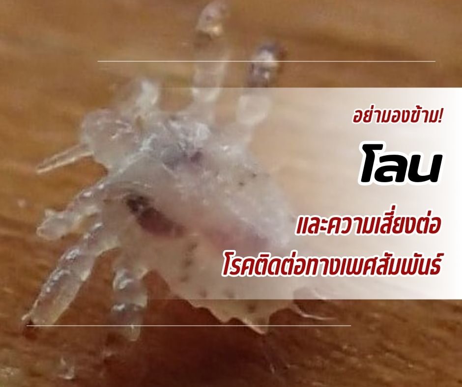 อย่ามองข้าม! โลน และความเสี่ยงต่อโรคติดต่อทางเพศสัมพันธ์