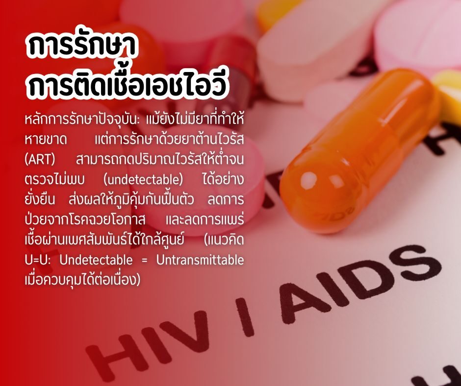 การรักษาการติดเชื้อเอชไอวี