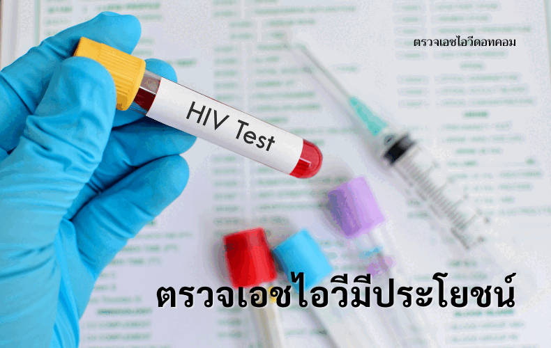 5 ความเชื่อผิด ๆ เกี่ยวกับการตรวจเอชไอวี
