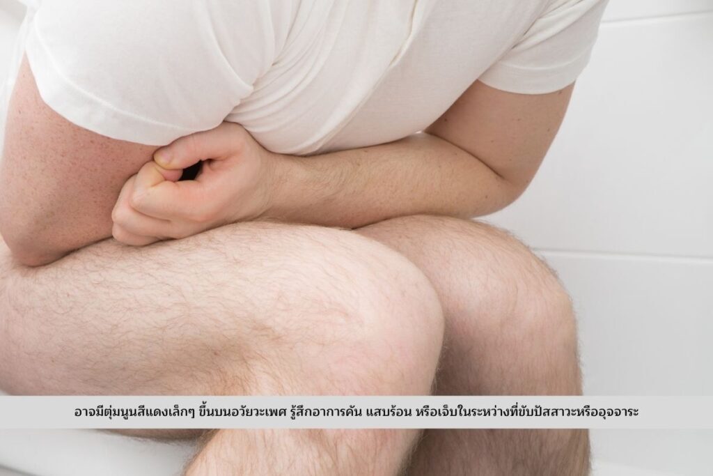 อาการคัน แสบร้อน หรือเจ็บ