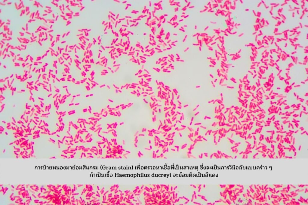ย้อมสีแกรม (Gram stain)