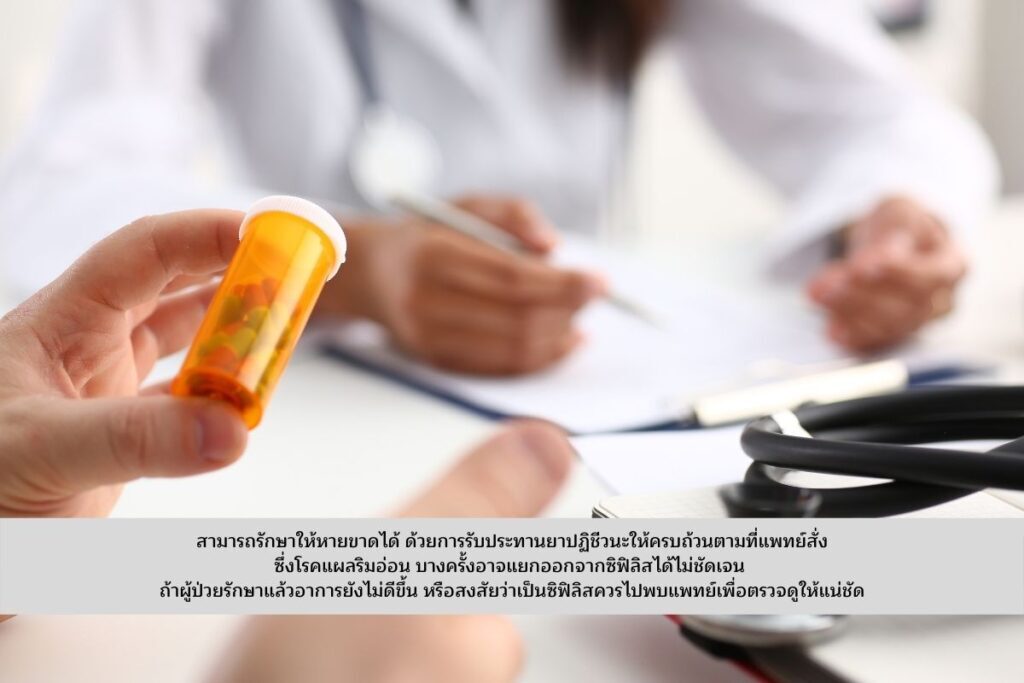 การรักษาแผลริมอ่อน