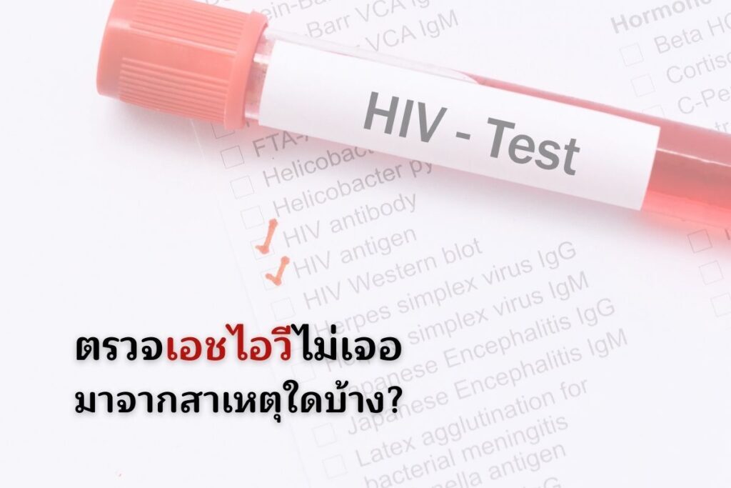 ตรวจเอชไอวีไม่เจอ มาจากสาเหตุใดบ้าง?