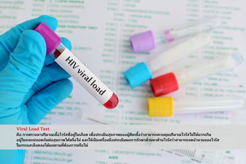 Viral Load Test