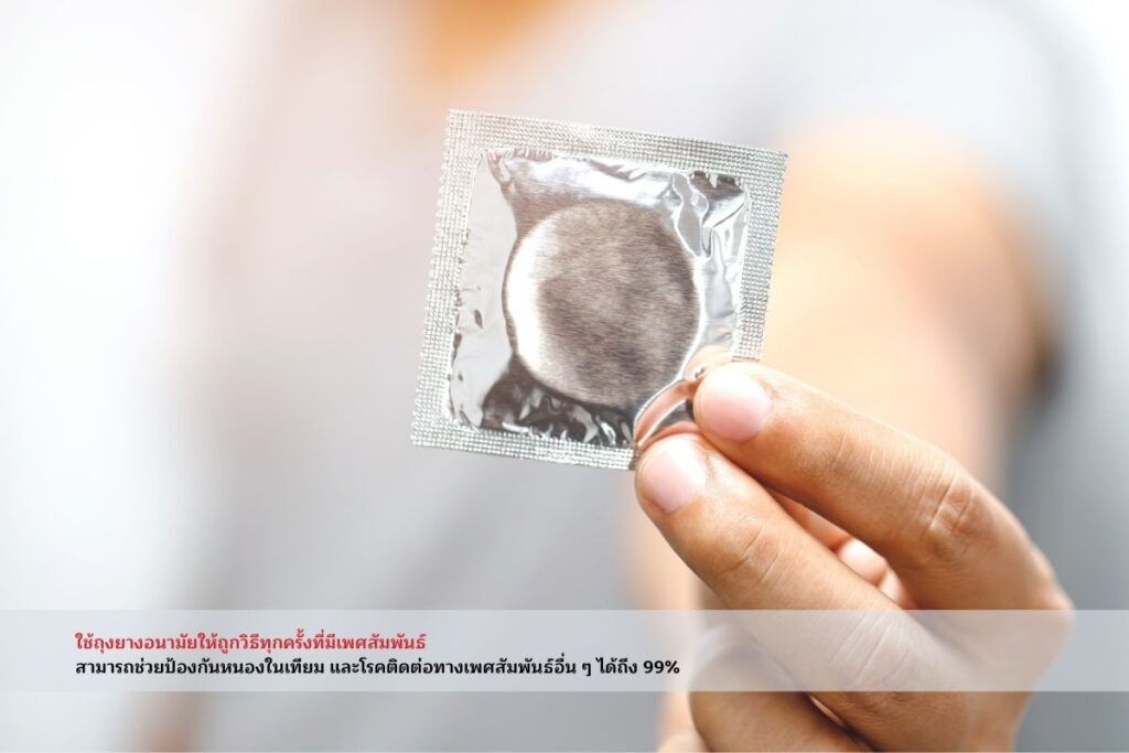โรคหนองในเทียม-ถุงยางอนามัย