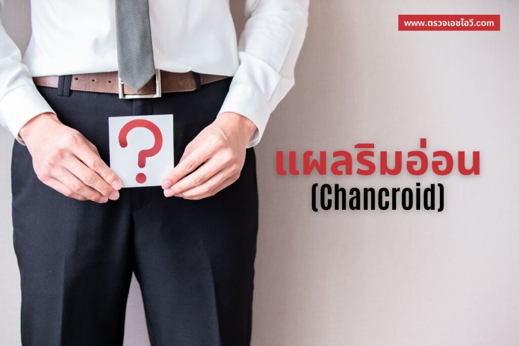 แผลริมอ่อน (Chancroid)