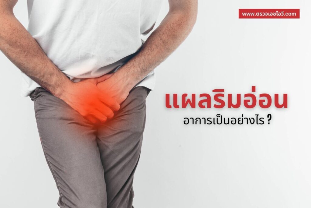 แผลริมอ่อน