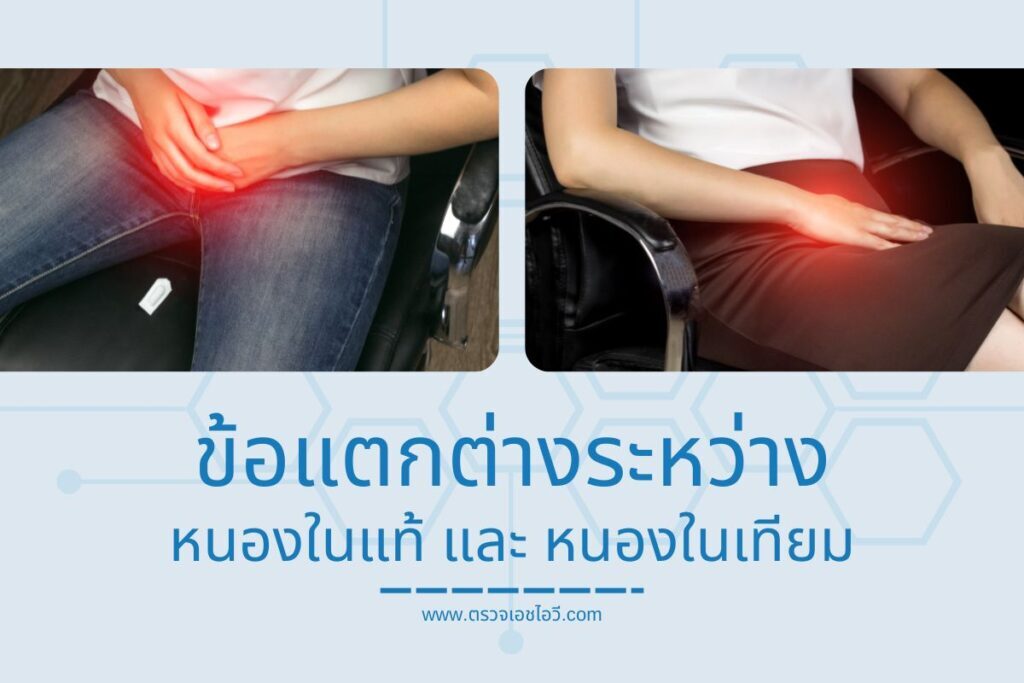 ข้อแตกต่างระหว่างหนองในแท้ และ หนองในเทียม