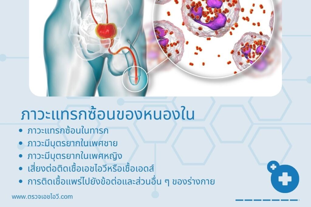ภาวะแทรกซ้อนของหนองใน