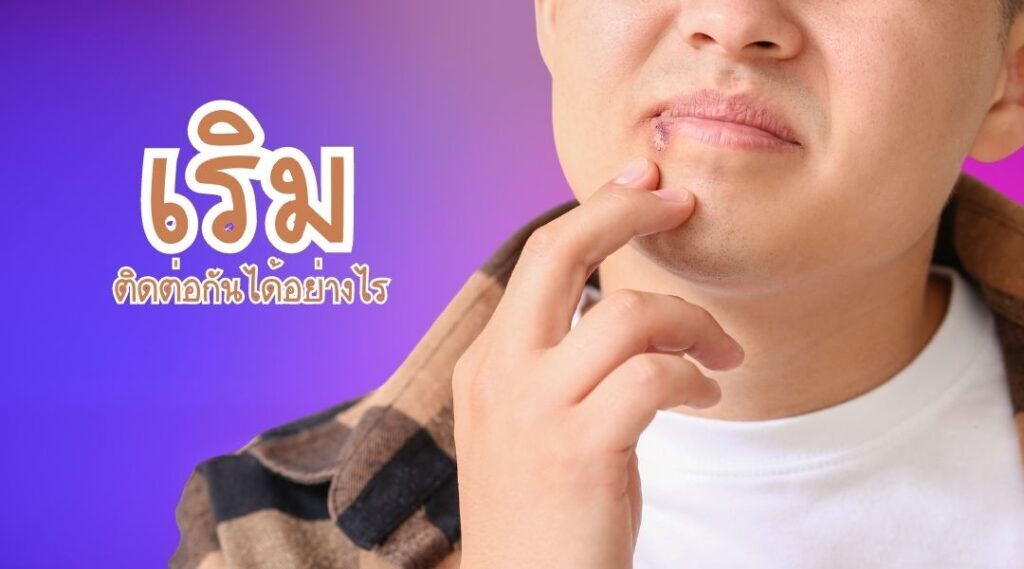 เริม ติดต่อกันได้อย่างไร