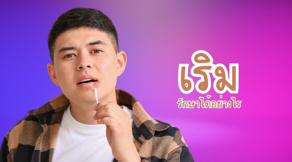เริม รักษาได้อย่างไร