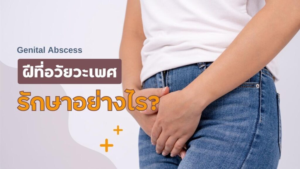 ฝีที่อวัยวะเพศ รักษาอย่างไร?