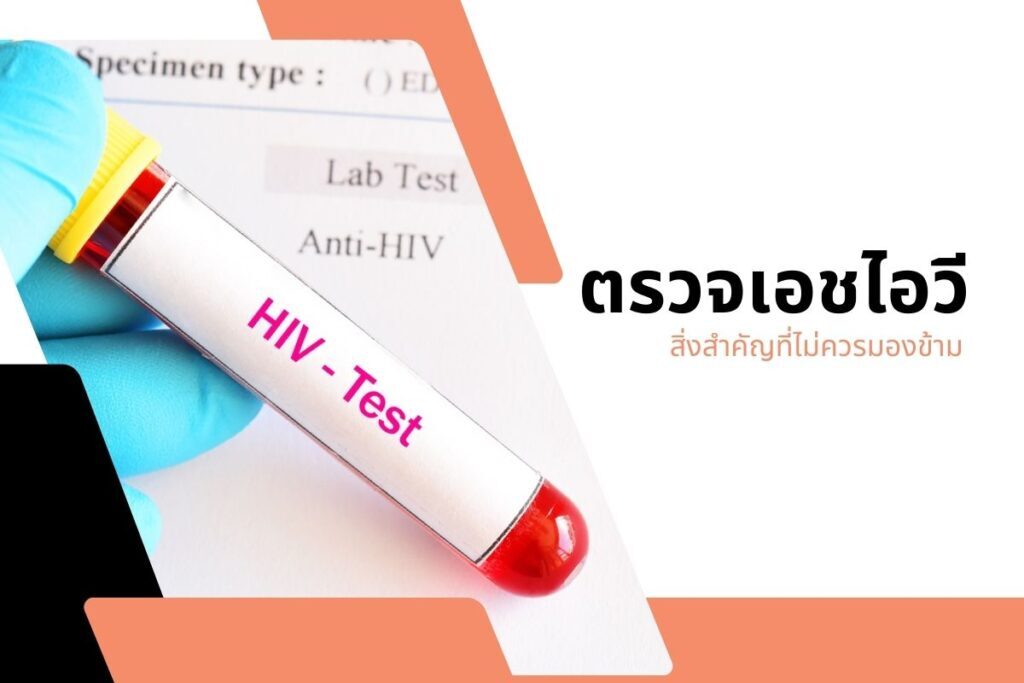 ตรวจเอชไอวี สิ่งสำคัญที่ไม่ควรมองข้าม