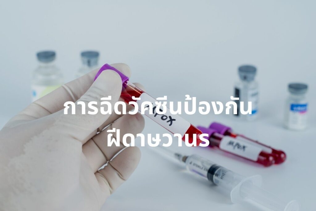 ฝีดาษวานร