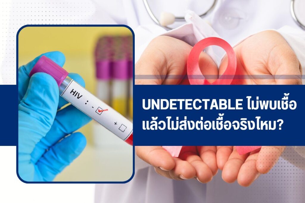 Undetectable ไม่พบเชื้อแล้วไม่ส่งต่อเชื้อจริงไหม?