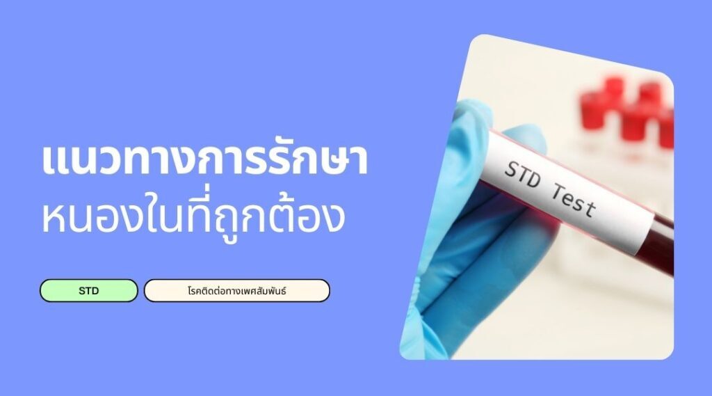 แนวทางการรักษาหนองในที่ถูกต้อง