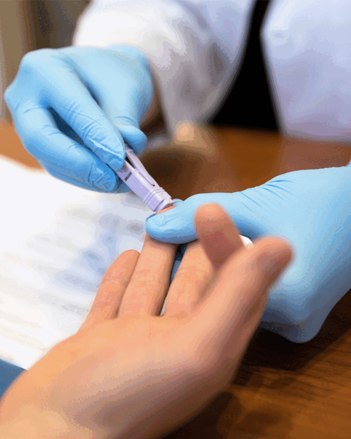 การตรวจเอชไอวี(HIV)