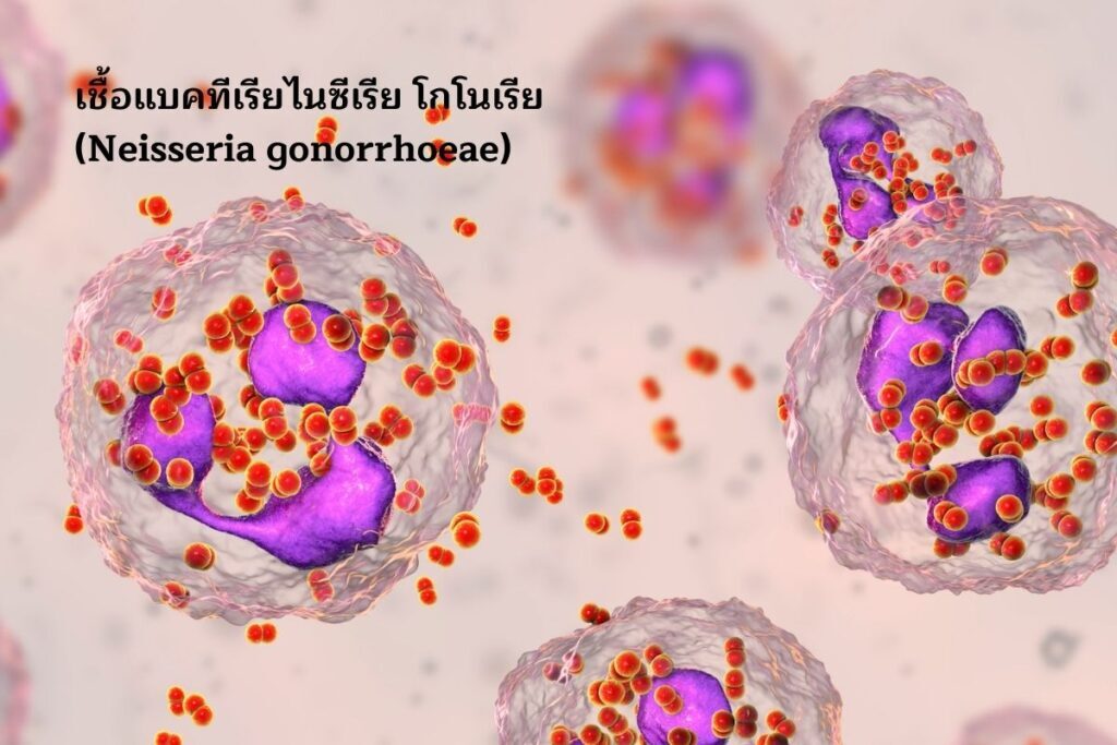 ไนซีเรีย โกโนเรีย