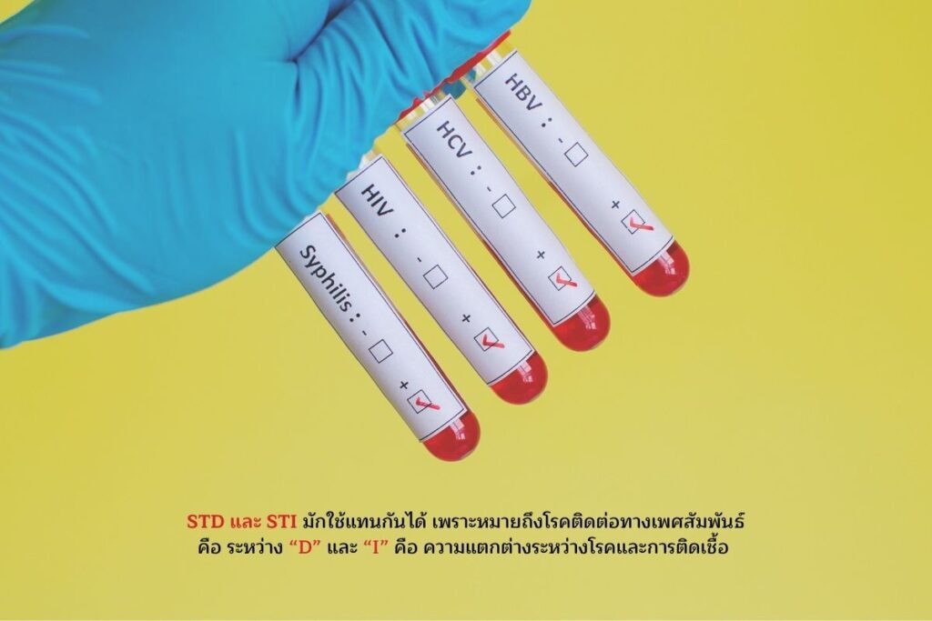 ความแตกต่าง