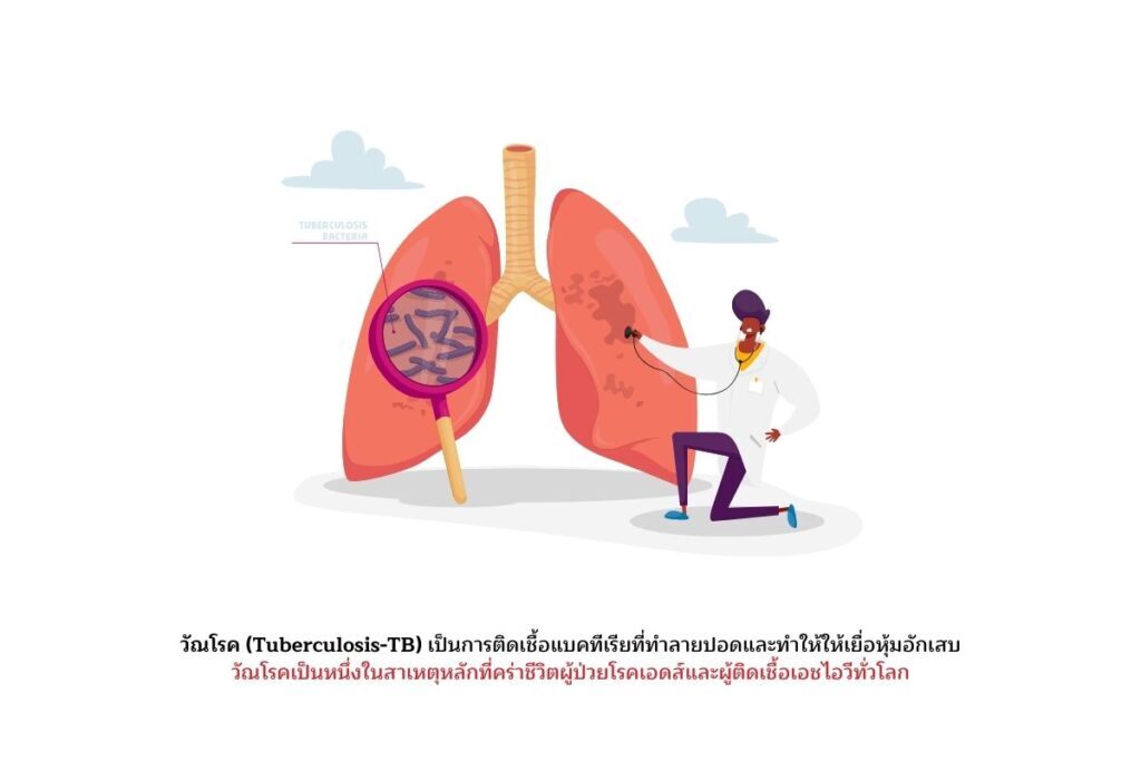 วัณโรคในผู้ป่วยเอชไอวี