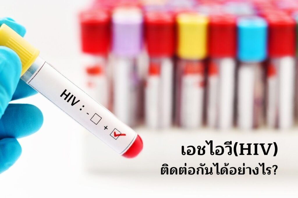 เอชไอวีติดต่อกันได้อย่างไร สาเหตุและช่องทางการติดเชื้อ