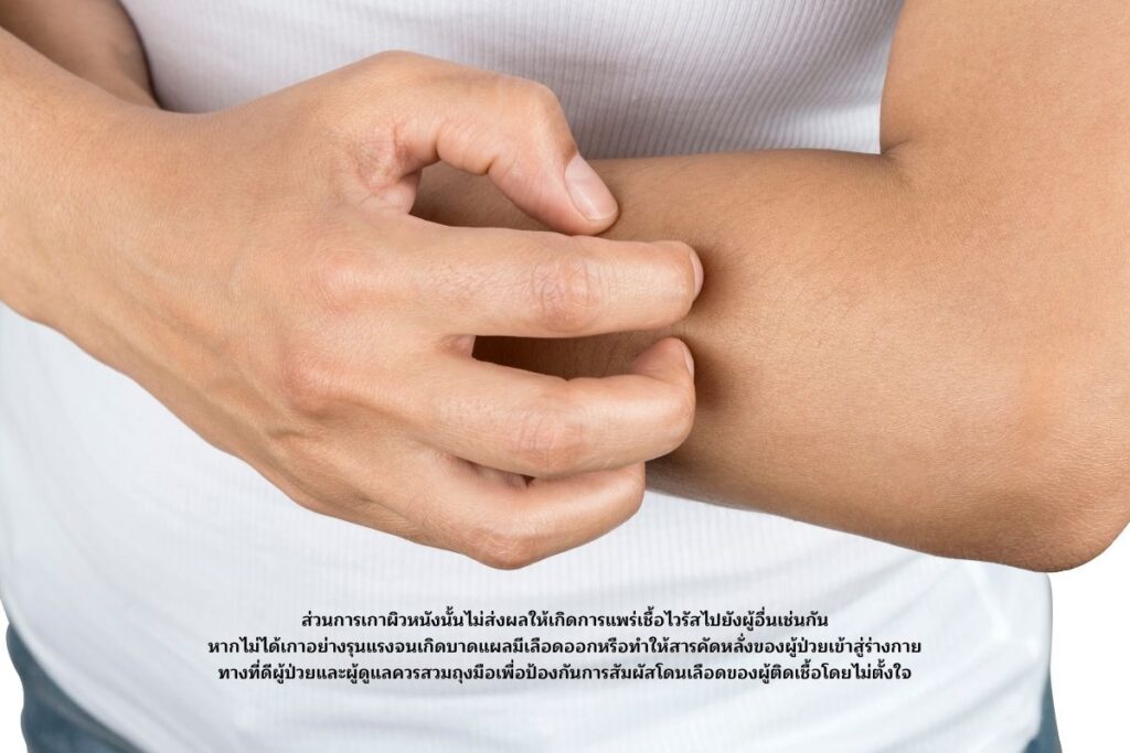 เกาผิวหนัง