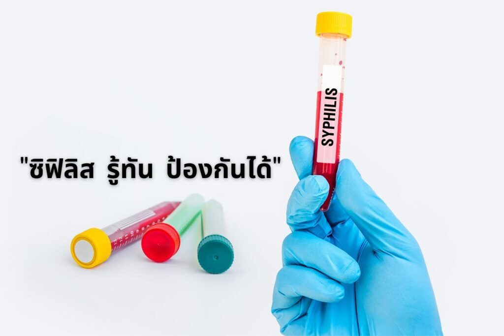 ซิฟิลิส รู้ทัน ป้องกันได้