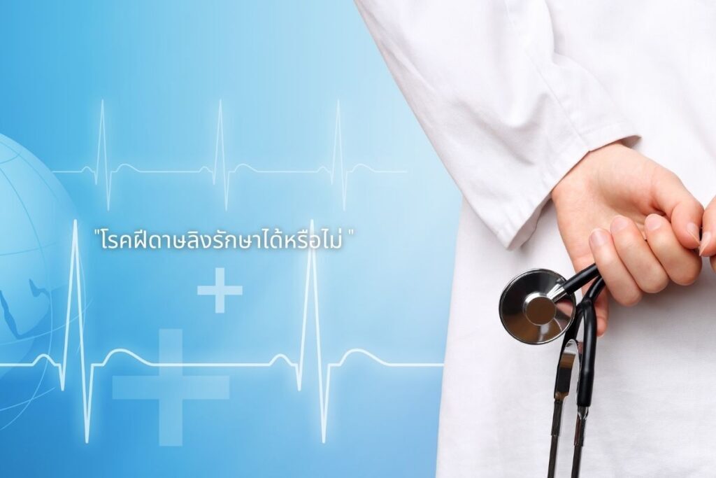 โรคฝีดาษลิงรักษาได้หรือไม่