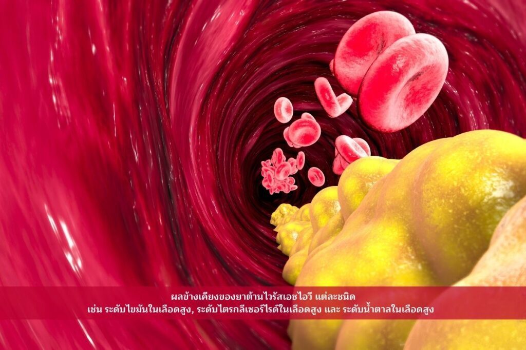 ระดับไขมันในเลือดสูง