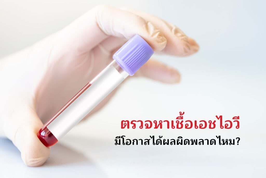 ตรวจหาเชื้อเอชไอวี มีโอกาสได้ผลผิดพลาดไหม?