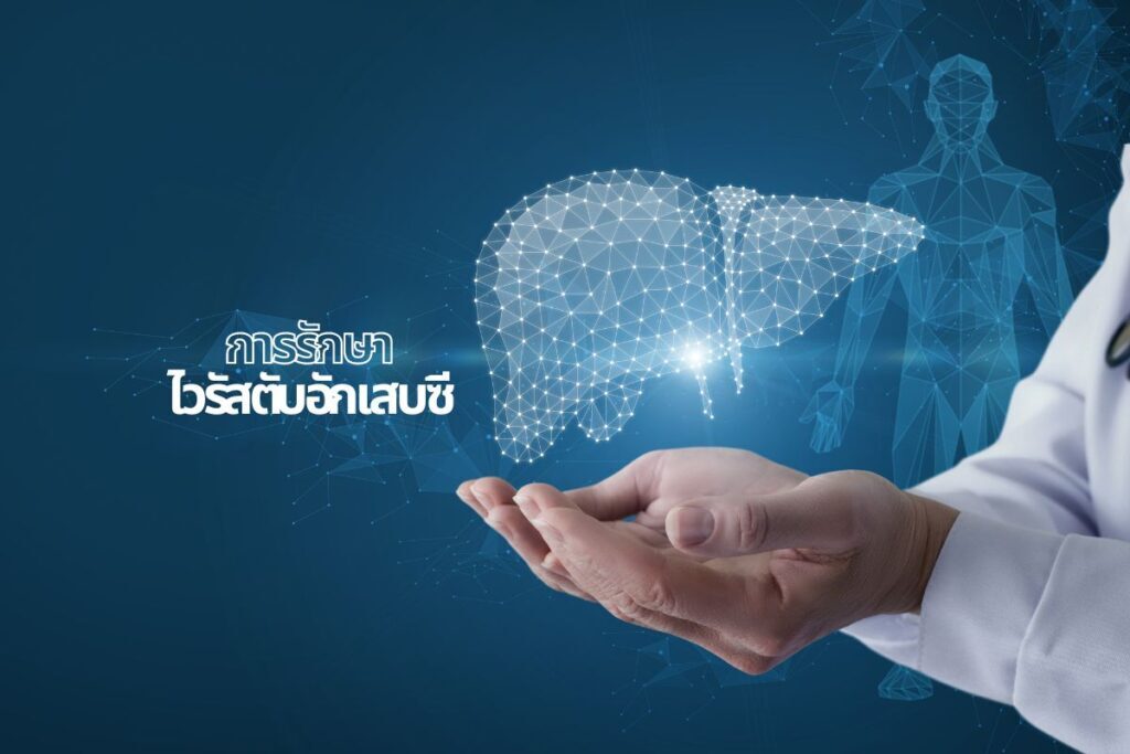 การรักษา ไวรัสตับอักเสบซี