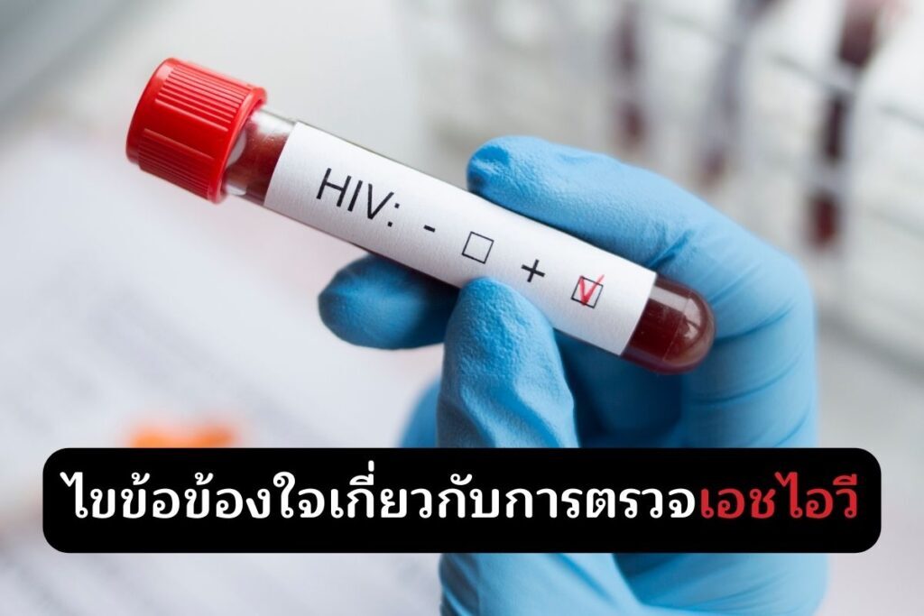 ไขข้อข้องใจเกี่ยวกับการตรวจเอชไอวี