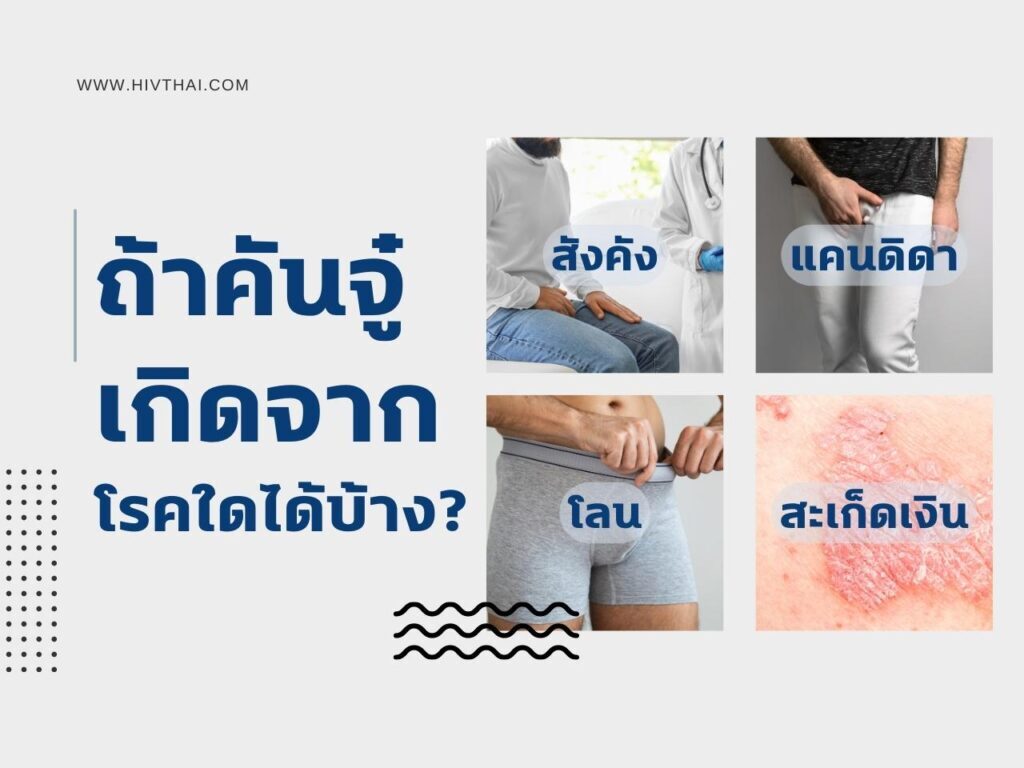 อาการคันอวัยวะเพศชาย เกิดจากโรคใดได้บ้าง