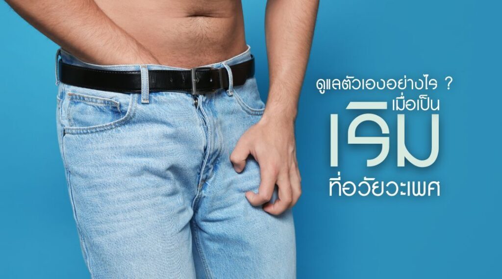 ดูแลตัวเองอย่างไร ?..เมื่อเป็นเริมที่อวัยวะเพศ