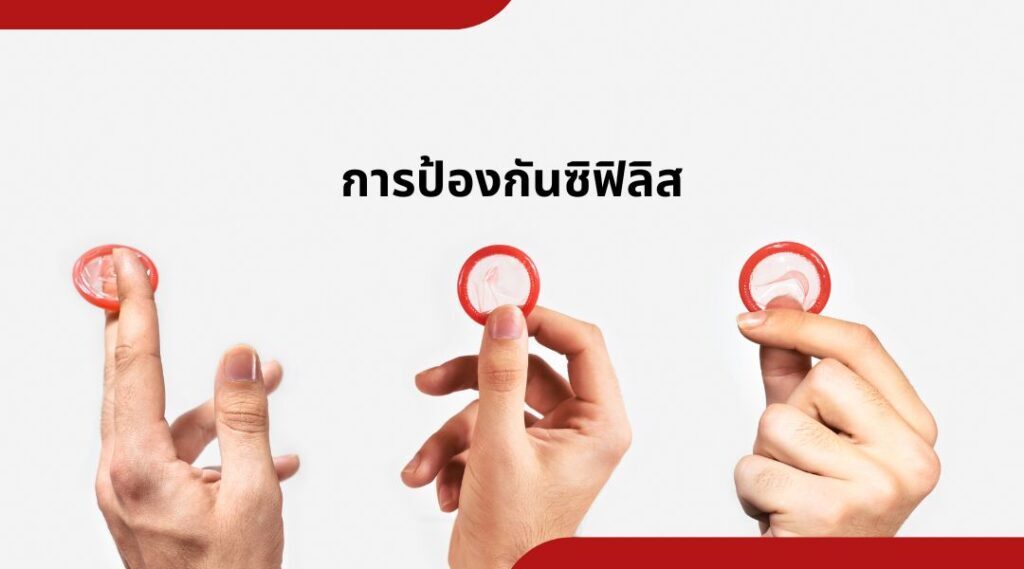การป้องกันซิฟิ ลิส