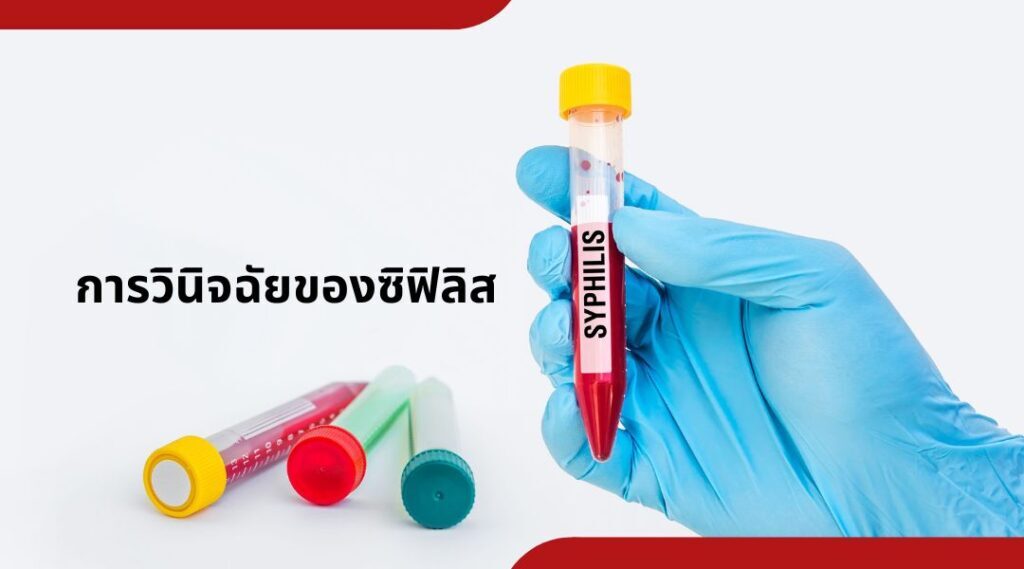 การวินิจฉัยของซิฟิลิส