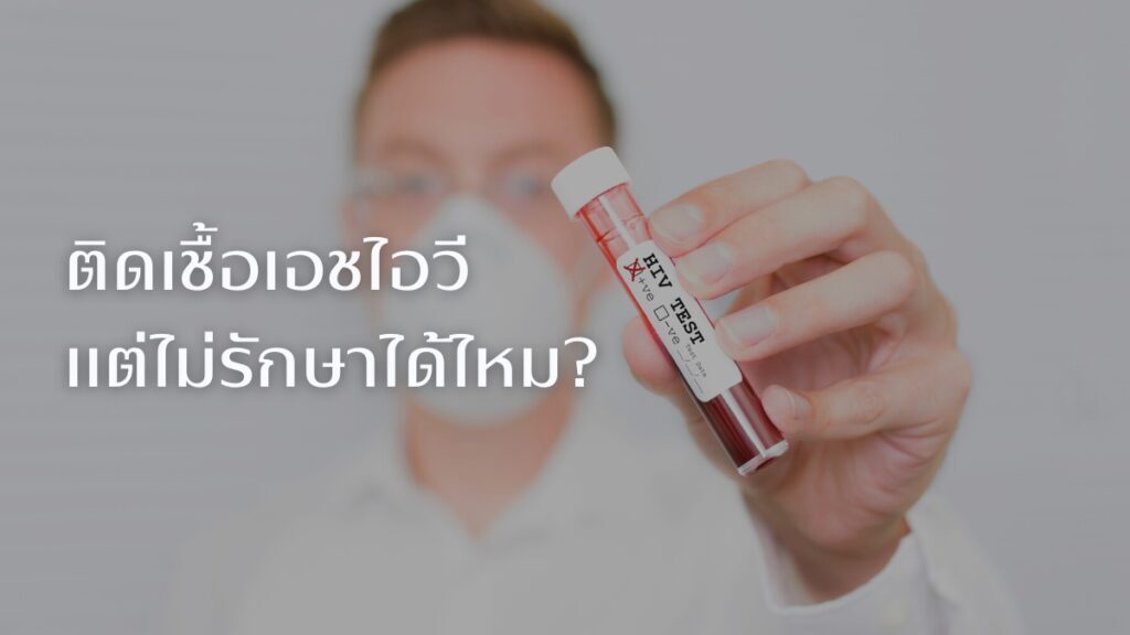 ไม่รักษาเอชไอวี ได้ไหม?