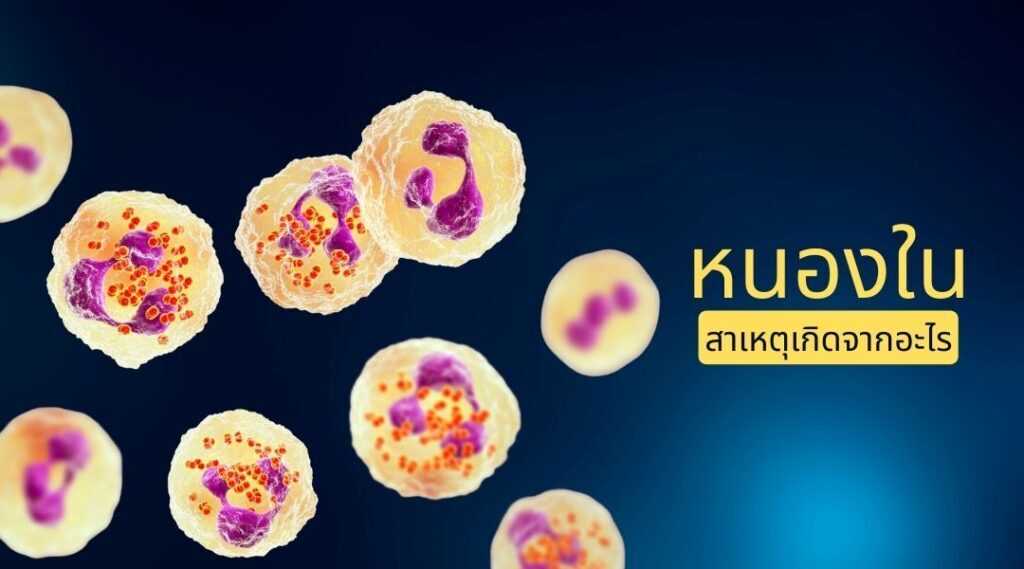 หนองใน สาเหตุเกิดจาก อะไร