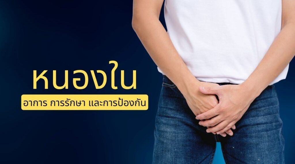 หนองใน : อาการ การรักษา และการป้องกัน