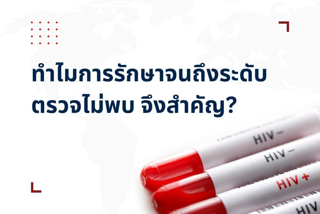 Undetectable สำคัญอย่างไรกับผู้อยู่ร่วมกับเชื้อเอชไอวี